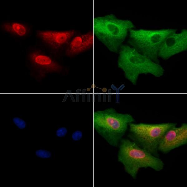 MYOCD Antibody - DF2434 staining A549 cells by IF/ICC.