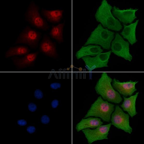 CITED2 Antibody - DF2455 staining Hela cells by IF/ICC.