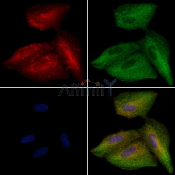 FAIM1 Antibody - DF2492 staining A549 cells by IF/ICC.