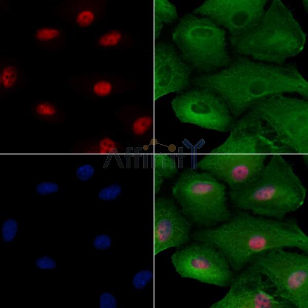FGF14 Antibody - DF2494 staining A549 cells by IF/ICC.