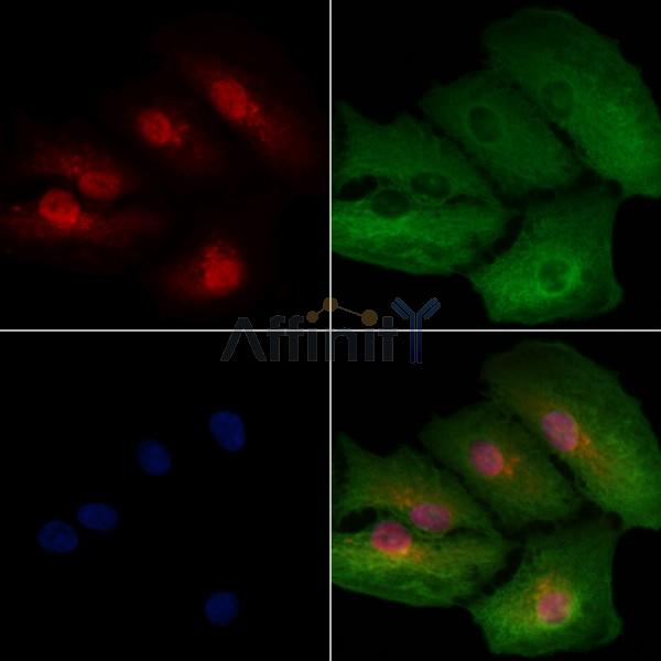 HSPB9 Antibody - DF2507 staining A549 cells by IF/ICC.