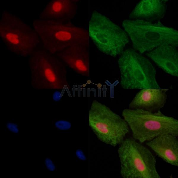 IL16 Antibody - DF2522 staining A549 cells by IF/ICC.
