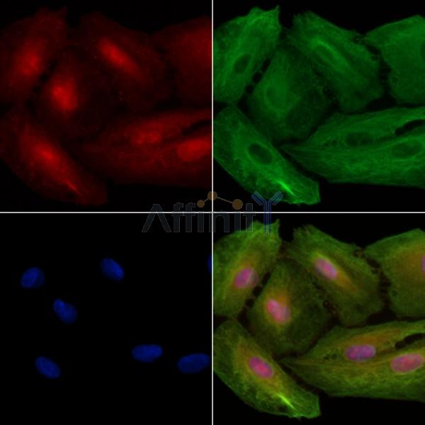 ALKBH4 Antibody - DF2584 staining A549 cells by IF/ICC.