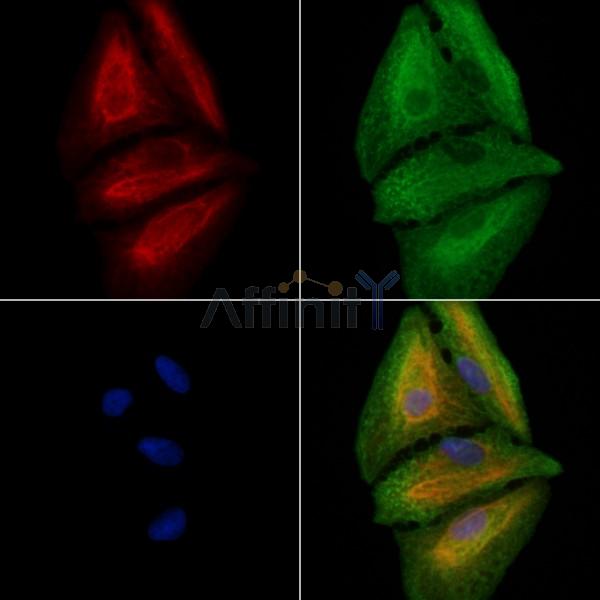 CANT1 Antibody - DF2590 staining A549 cells by IF/ICC.