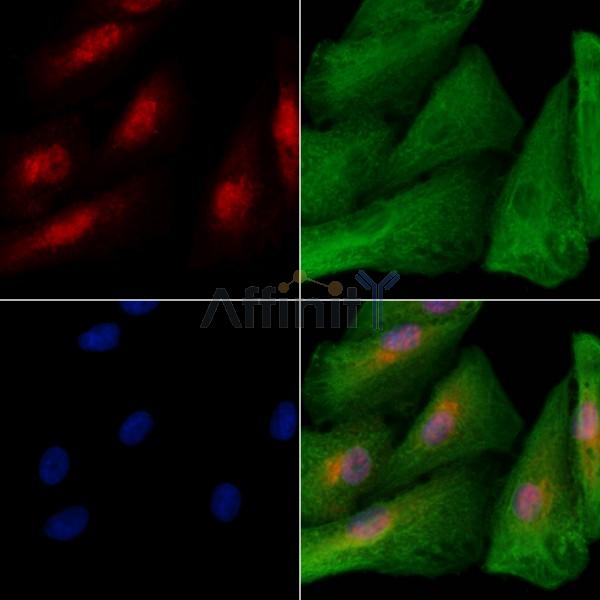 KLF12 Antibody - DF2593 staining A549 cells by IF/ICC.
