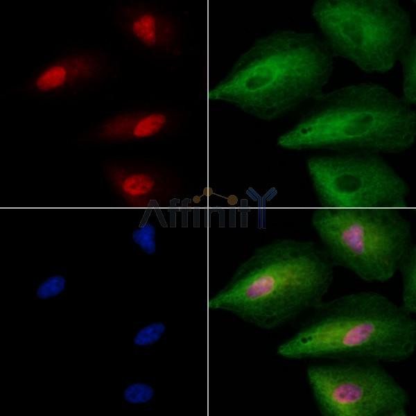 ING2 Antibody - DF2633 staining A549 cells by IF/ICC.