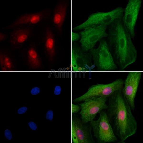 ING4 Antibody - DF2635 staining A549 cells by IF/ICC.