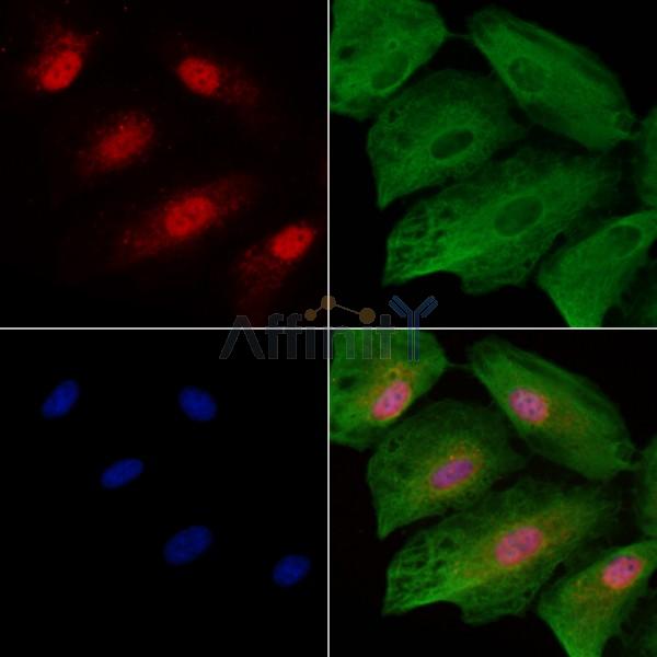 CIRBP Antibody - DF2643 staining A549 cells by IF/ICC.
