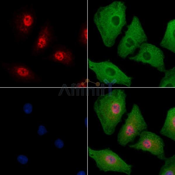 TSSK3 Antibody - DF2686 staining A549 cells by IF/ICC.
