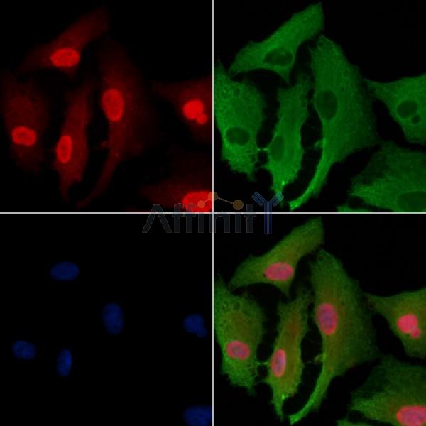 SGK494 Antibody - DF2691 staining A549 cells by IF/ICC.