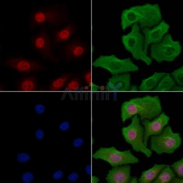 RBM5 Antibody - DF3206 staining Hela cells by IF/ICC.