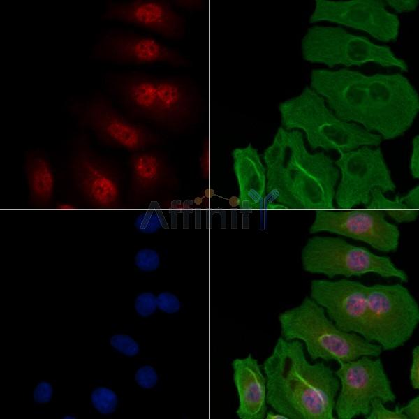hnRNP H Antibody - DF3219 staining Hela cells by IF/ICC.