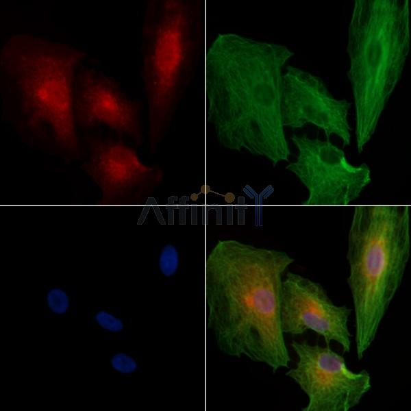 CD160 Antibody - DF3522 staining A549 cells by IF/ICC.