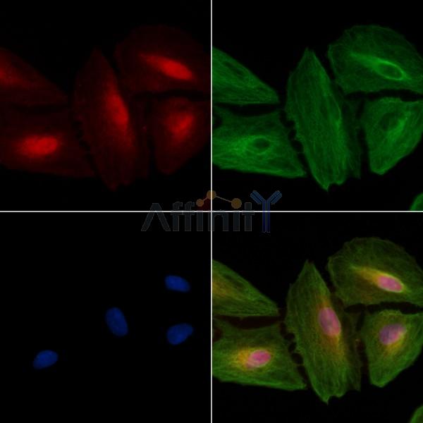 CDK5RAP3 Antibody - DF3547 staining A549 cells by IF/ICC.