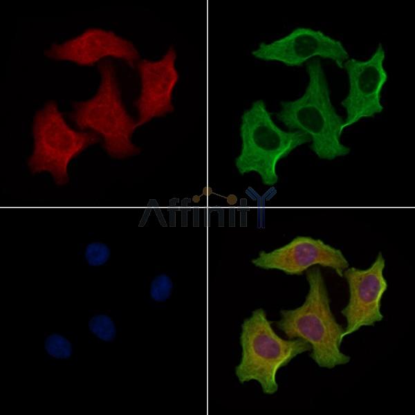 CBLN2 Antibody - DF3924 staining Hela cells by IF/ICC.