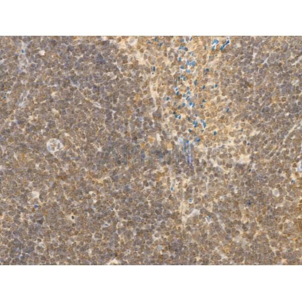 MNDA Antibody - DF4191 at 1/100 staining Mouse spleen tissue by IHC-P.