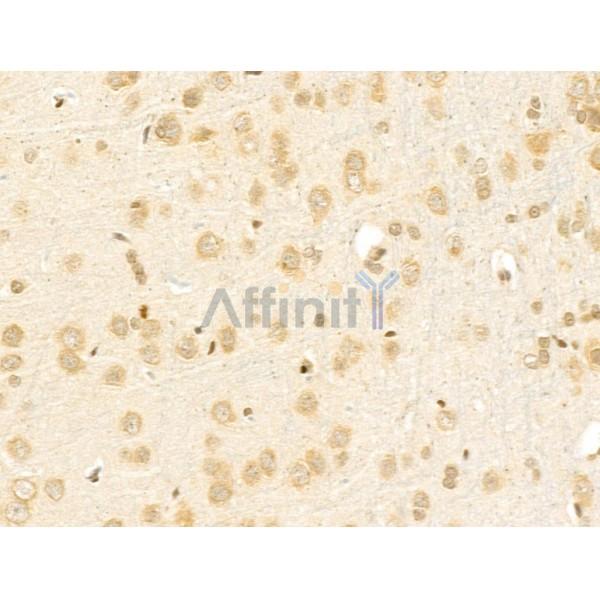 NBPF1/9/10/12/14/15/16/20 Antibody - DF4233 at 1/100 staining Rat brain tissue by IHC-P.
