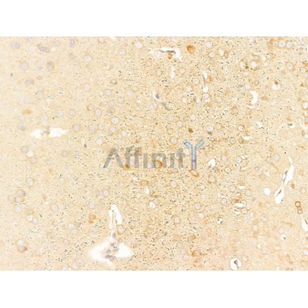 SLC30A4 Antibody - DF4633 at 1/100 staining Rat brain tissue by IHC-P.