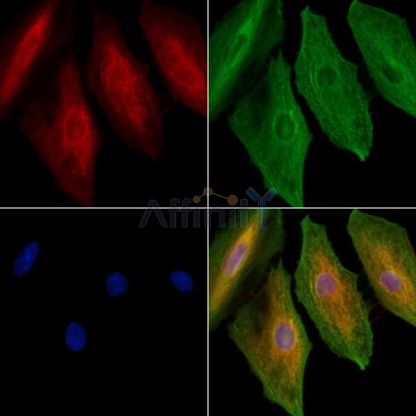 EMR4 Antibody - DF4925 staining A549 cells by IF/ICC.