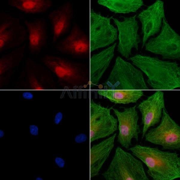 PELP1 Antibody - DF7242 staining A549 cells by IF/ICC.