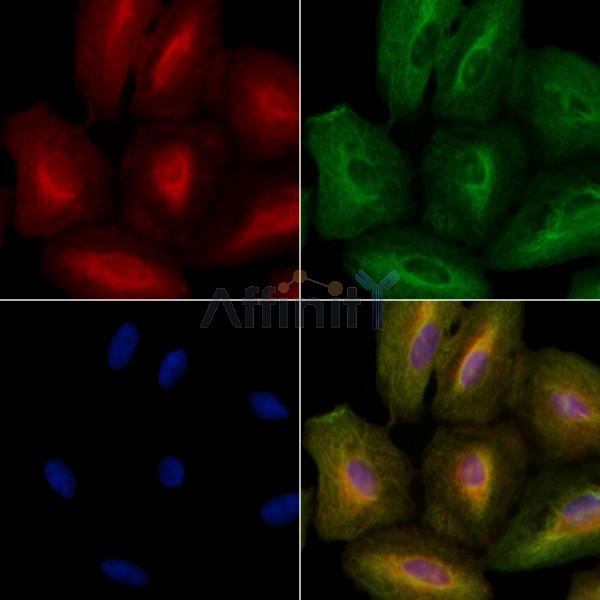 IHH Antibody - DF7688 staining A549 cells by IF/ICC.