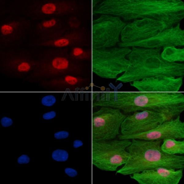 ZKSCAN3 Antibody - DF7752 staining A549 cells by IF/ICC.
