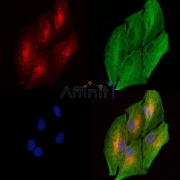 DAB2 Antibody - DF7792 staining A549 cells by IF/ICC.