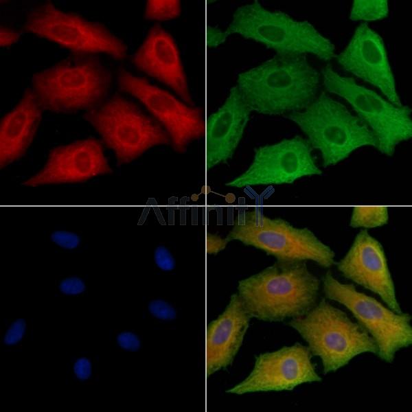 SCARF1 Antibody - DF7922 staining A549 cells by IF/ICC.