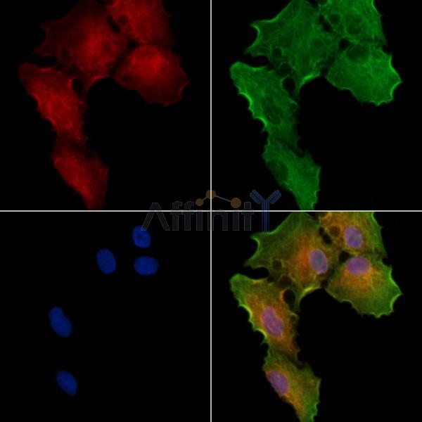 CGB Antibody - DF7923 staining A549 cells by IF/ICC.