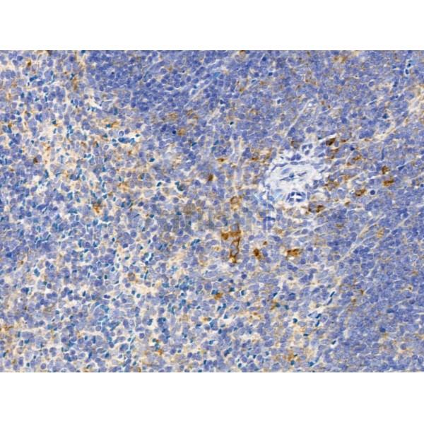 TRAM2 Antibody - DF8241 at 1/100 staining Mouse spleen tissue by IHC-P.