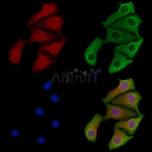 PPP1R9A Antibody - DF8257 staining Hela cells by IF/ICC.