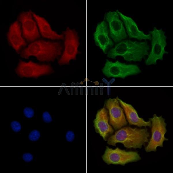 MPP1 Antibody - DF8276 staining Hela cells by IF/ICC.