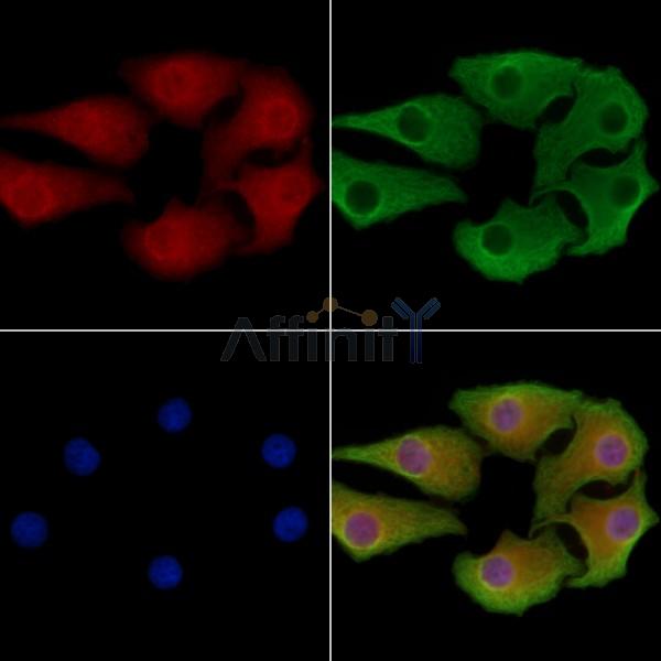 CDC123 Antibody - DF8289 staining Hela cells by IF/ICC.