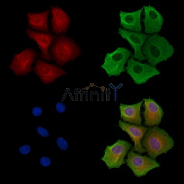 KIFAP3 Antibody - DF8293 staining Hela cells by IF/ICC.