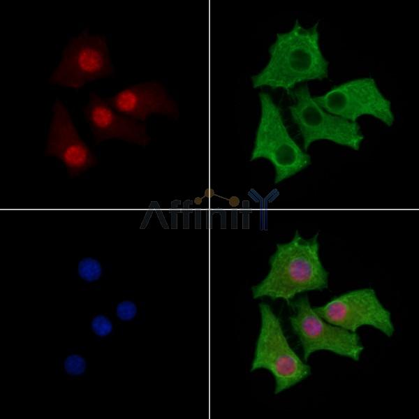 PKP3 Antibody - DF8310 staining Hela cells by IF/ICC.