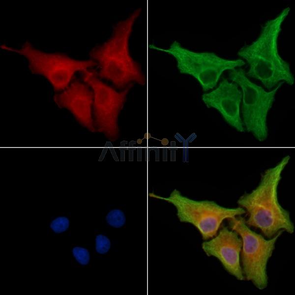 ERAP1 Antibody - DF8347 staining Hela cells by IF/ICC.