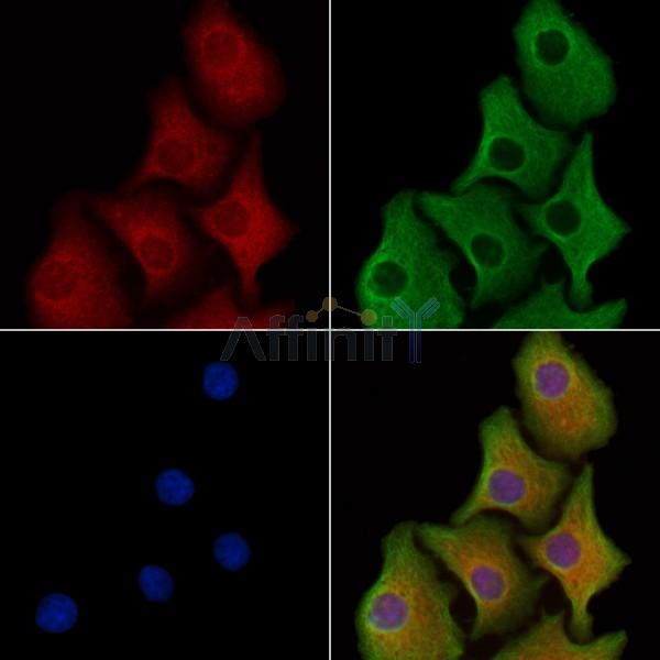 CAP2 Antibody - DF8357 staining Hela cells by IF/ICC.