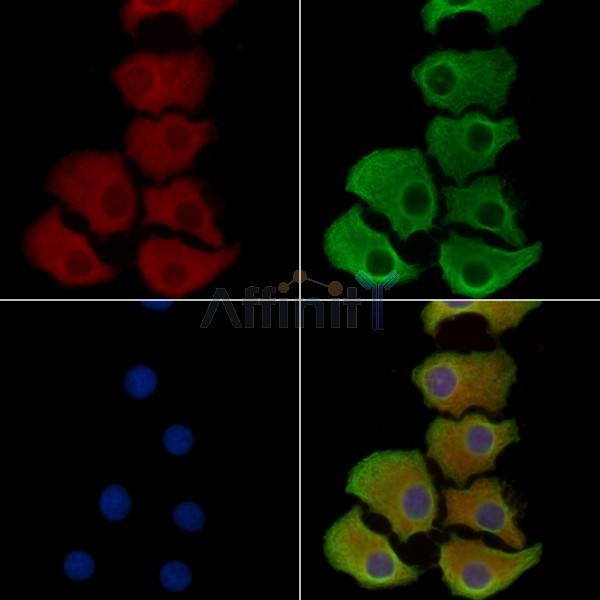 ABCG5 Antibody - DF8401 staining Hela cells by IF/ICC.