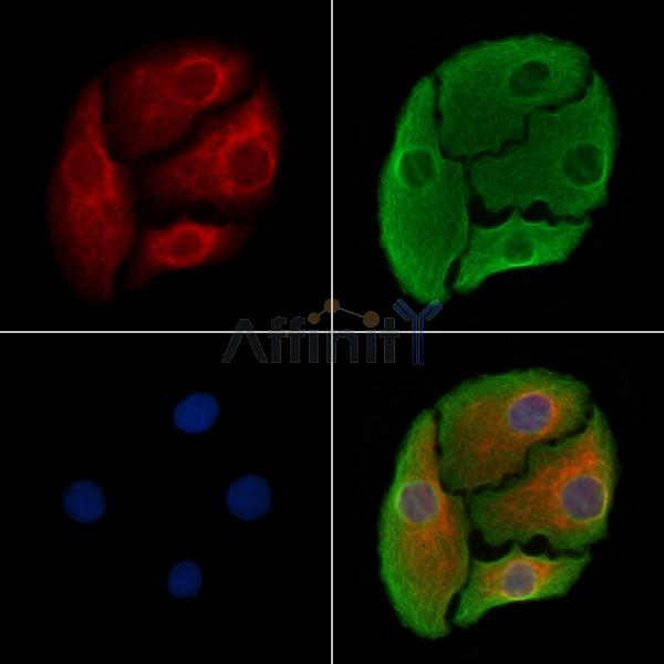 TPBG Antibody - DF8402 staining Hela cells by IF/ICC.