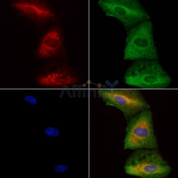LMAN1 Antibody - DF8460 staining A549 cells by IF/ICC.