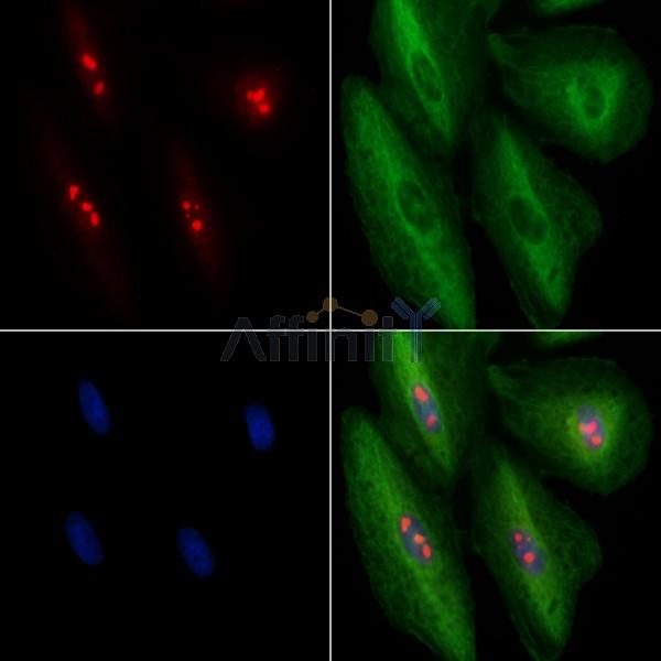 MYBBP1A Antibody - DF8468 staining A549 cells by IF/ICC.