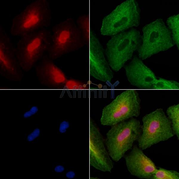 ASCL1 Antibody - DF8504 staining A549 cells by IF/ICC.