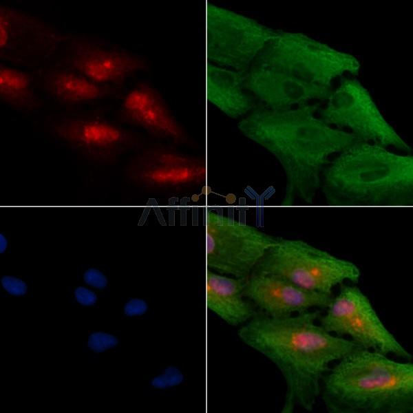 HoxB4 Antibody - DF8560 staining A549 cells by IF/ICC.