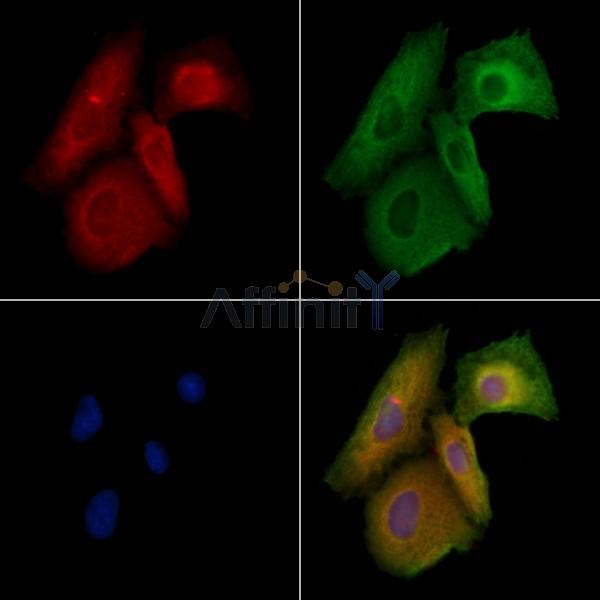 OPA1 Antibody - DF8587 staining A549 cells by IF/ICC.