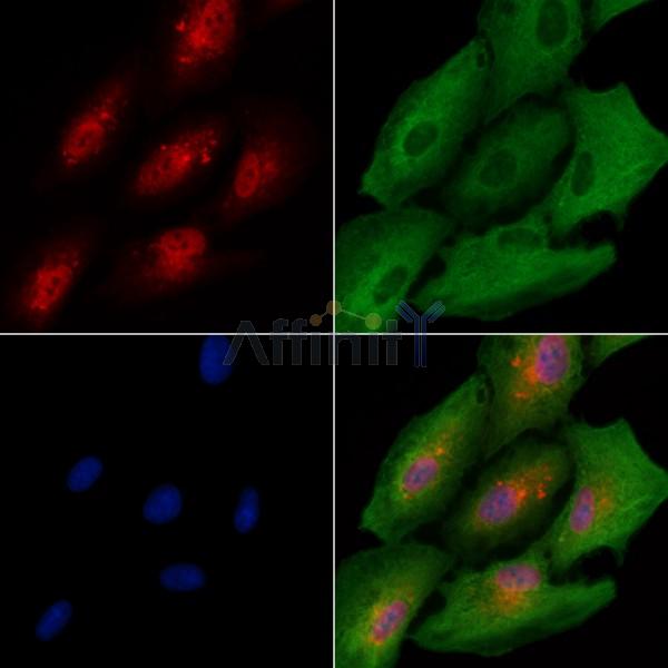 RFC3 Antibody - DF8600 staining A549 cells by IF/ICC.