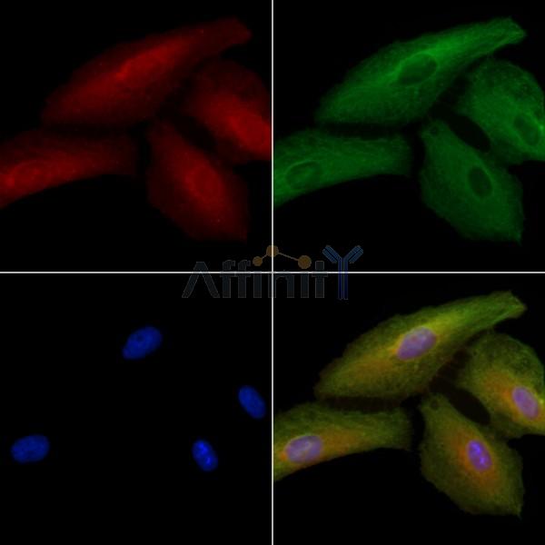 Sarcoglycan beta Antibody - DF8605 staining A549 cells by IF/ICC.
