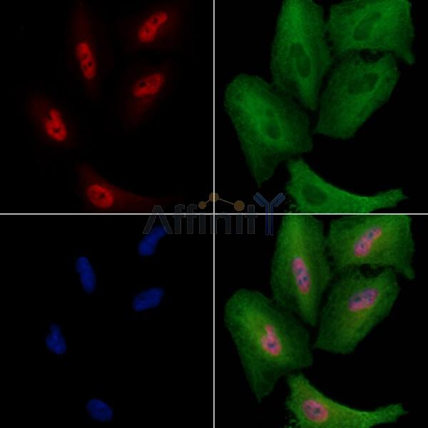 APC8 Antibody - DF8637 staining A549 cells by IF/ICC.