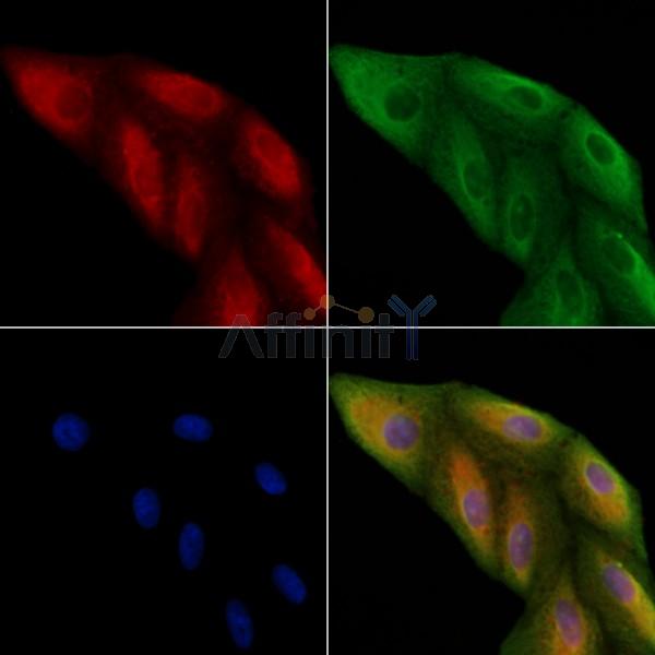 C56D2 Antibody - DF8641 staining A549 cells by IF/ICC.