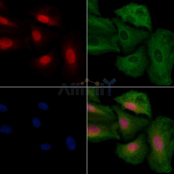CLK4 Antibody - DF8645 staining A549 cells by IF/ICC.