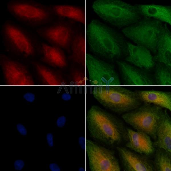 DHRS8 Antibody - DF8649 staining A549 cells by IF/ICC.